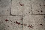 Chuligani brutalnie pobili byłego starostę łomżyńskiego